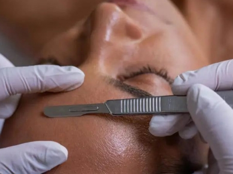 Curso de CURSO DE DERMAPLANING